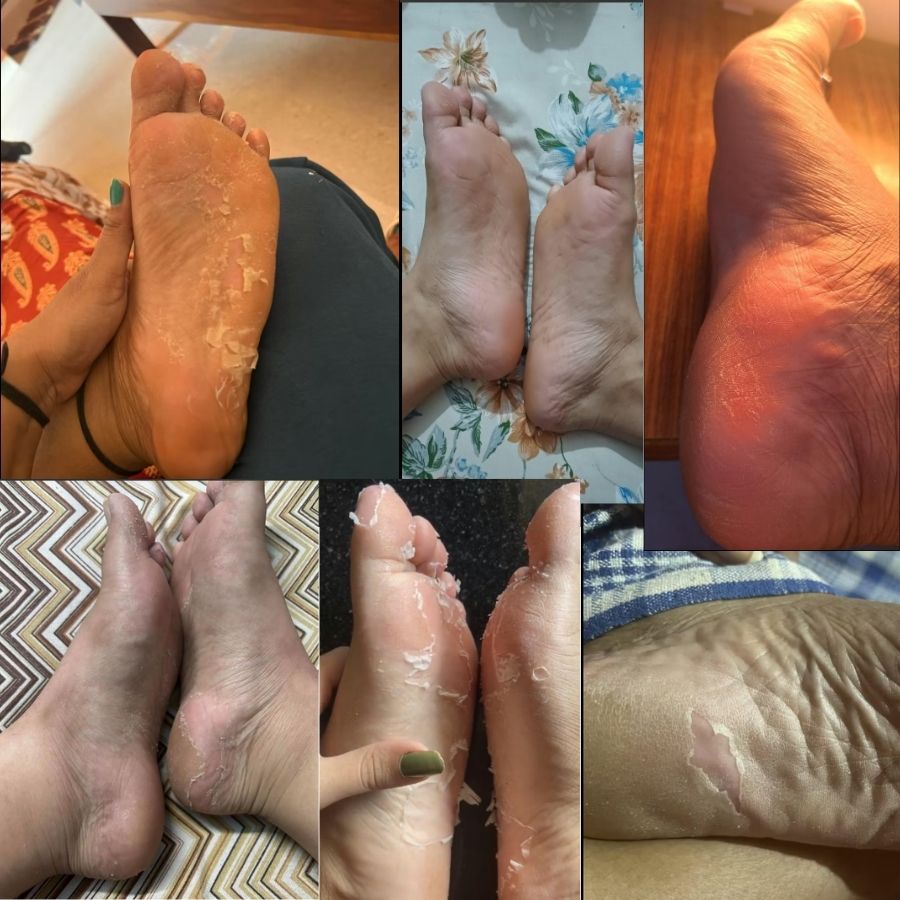 SLİMFOOT AYAK BAKIM MASKESİ